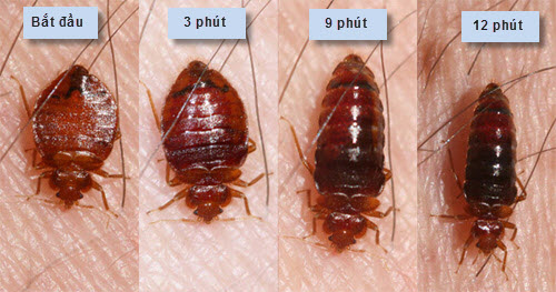 1417531182 bed bug feeding whitney cranshawb Cách để phát hiện phòng ngủ có rệp